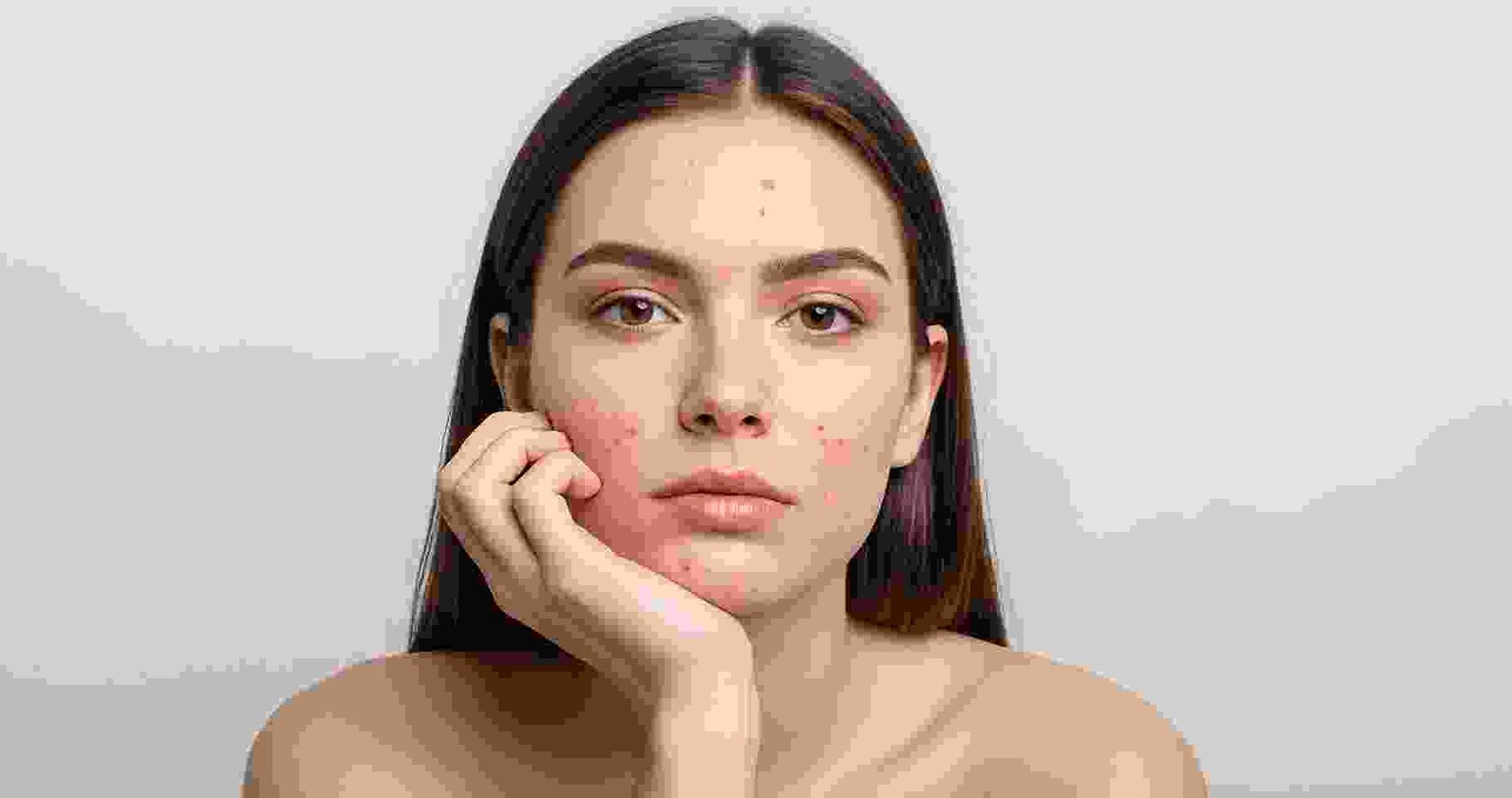 before-after-slide-img-01