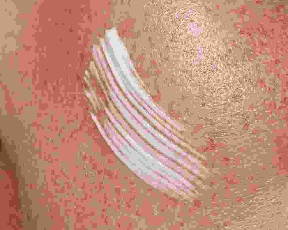 home2-aboutus-img-02